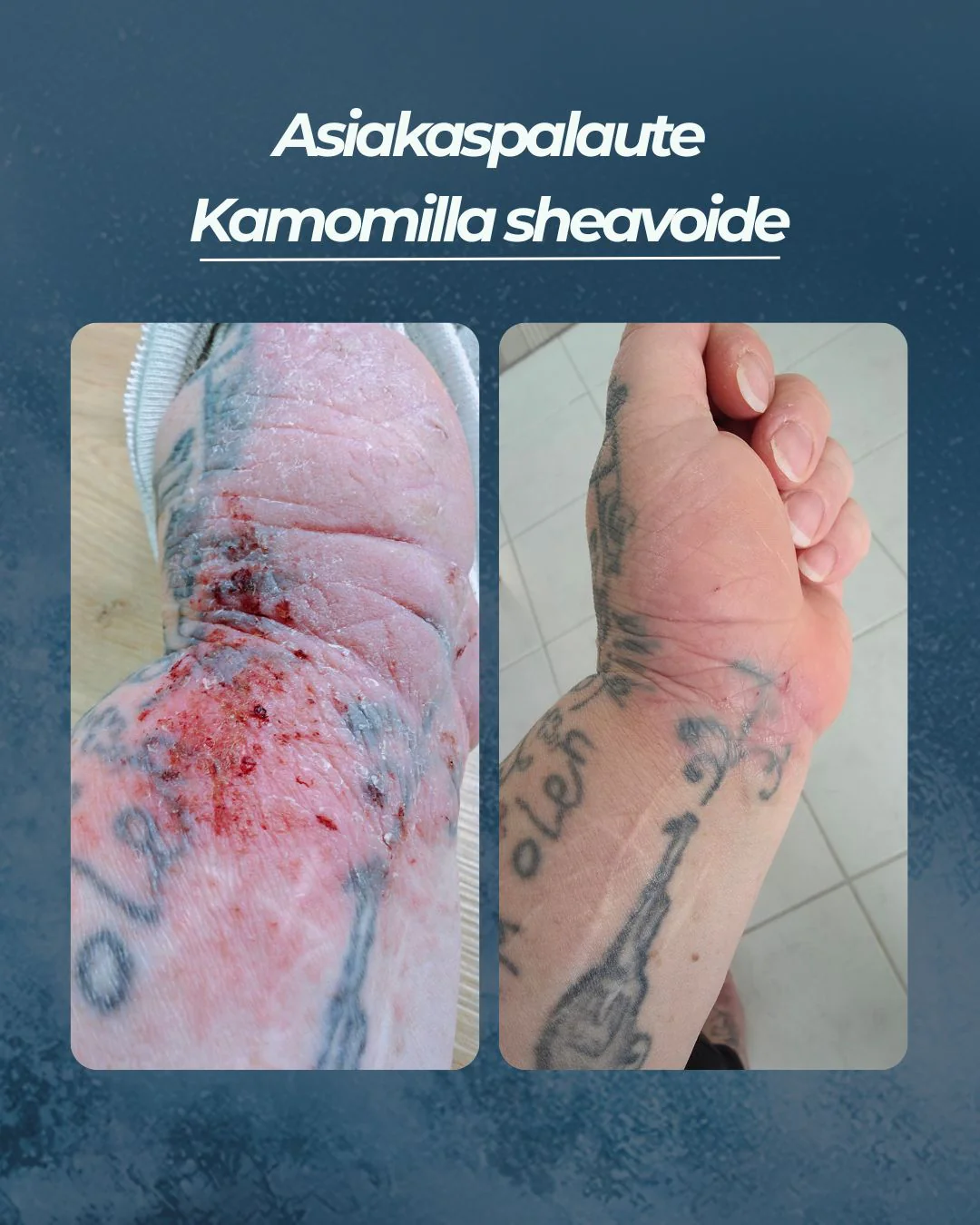 Tuotekuva 10