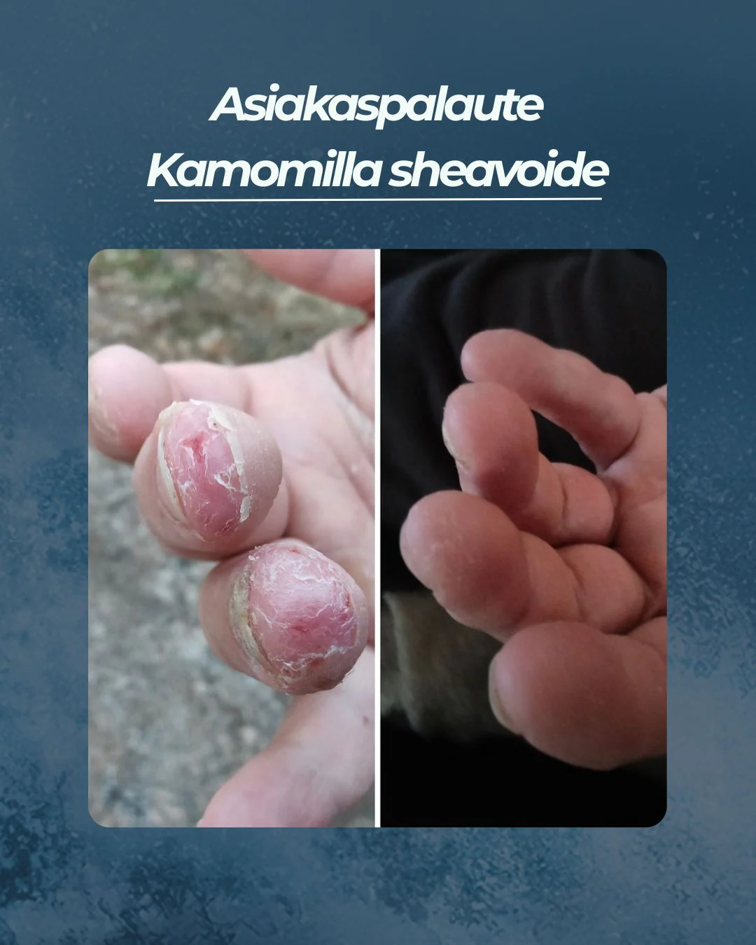 Tuotekuva 11