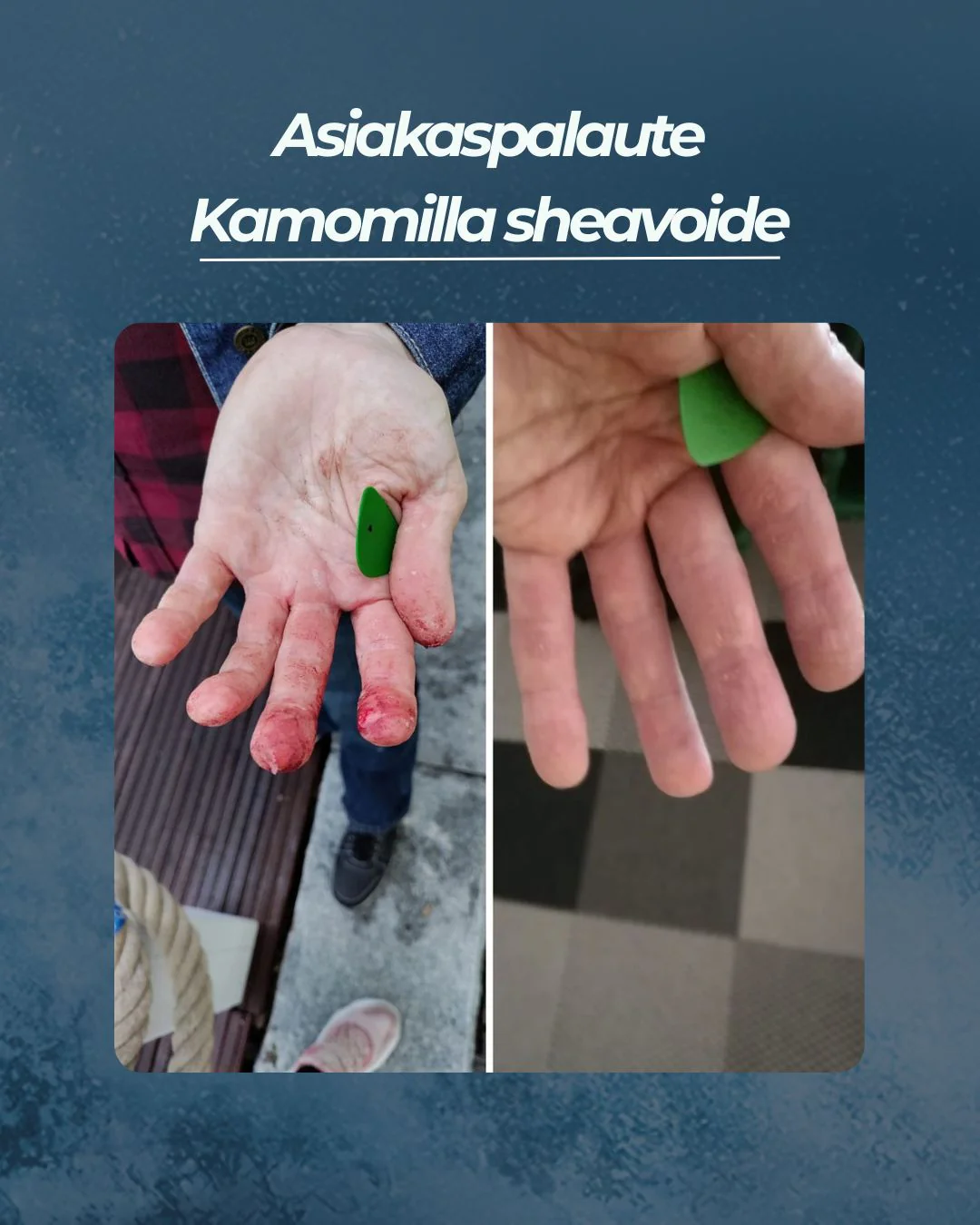 Tuotekuva 9