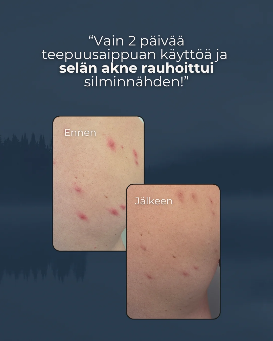Tuotekuva 4