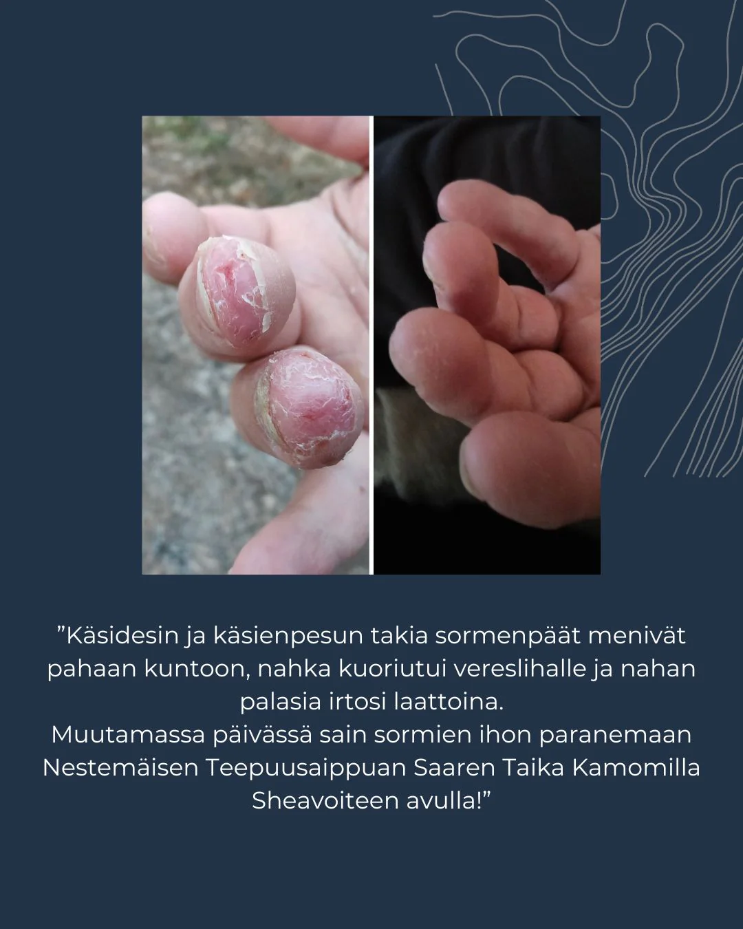 Tuotekuva 5