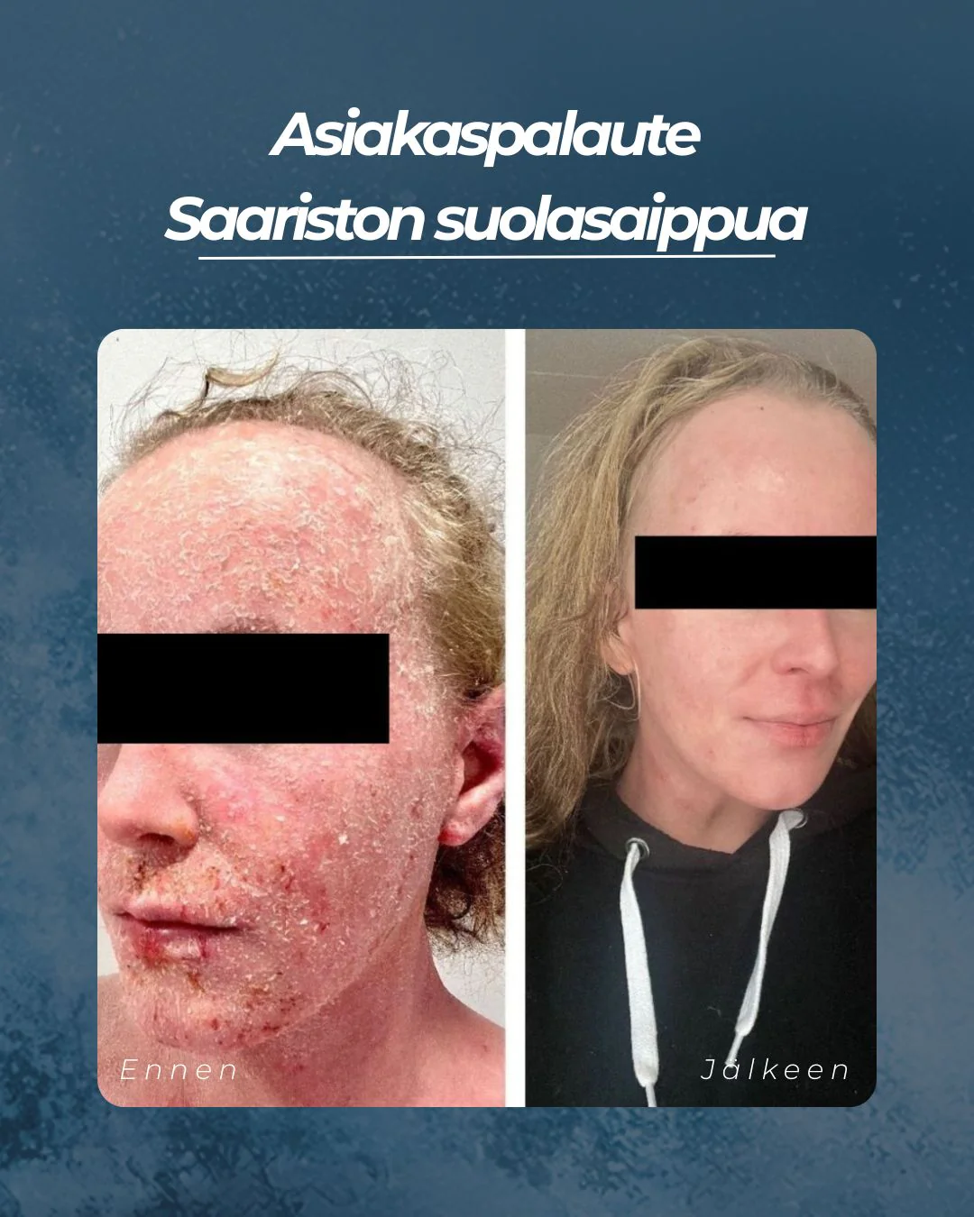 Tuotekuva 4