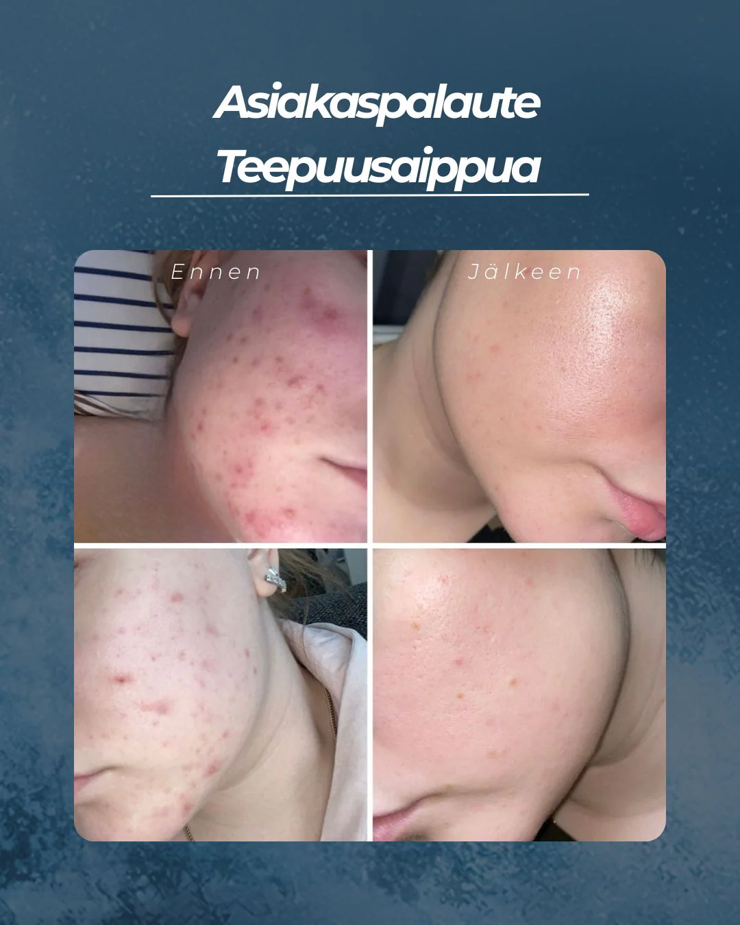 Tuotekuva 3