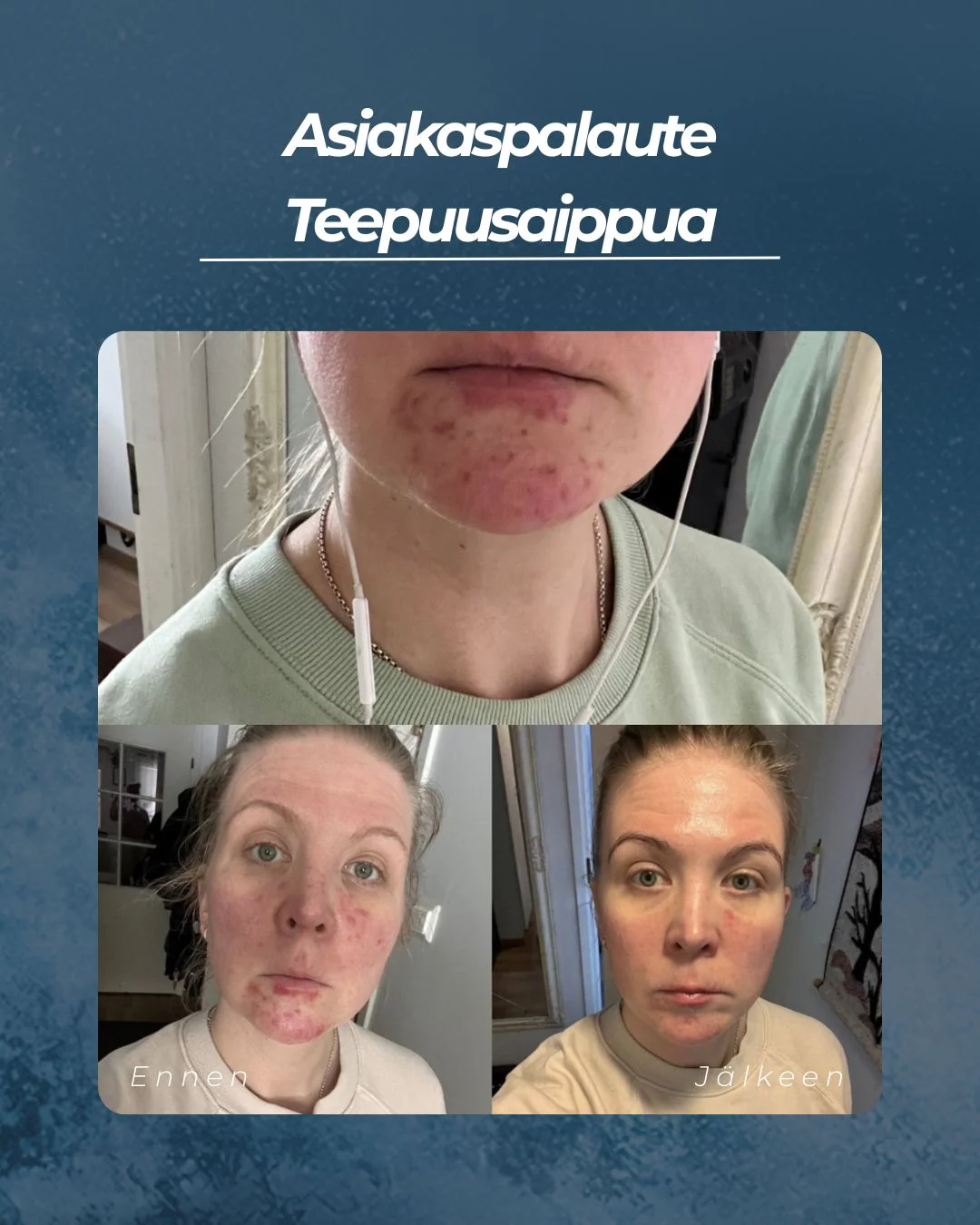 Tuotekuva 5