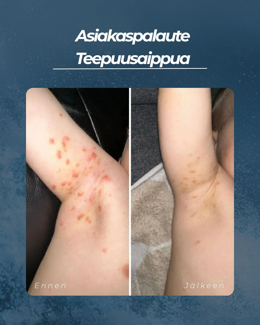 Tuotekuva 6
