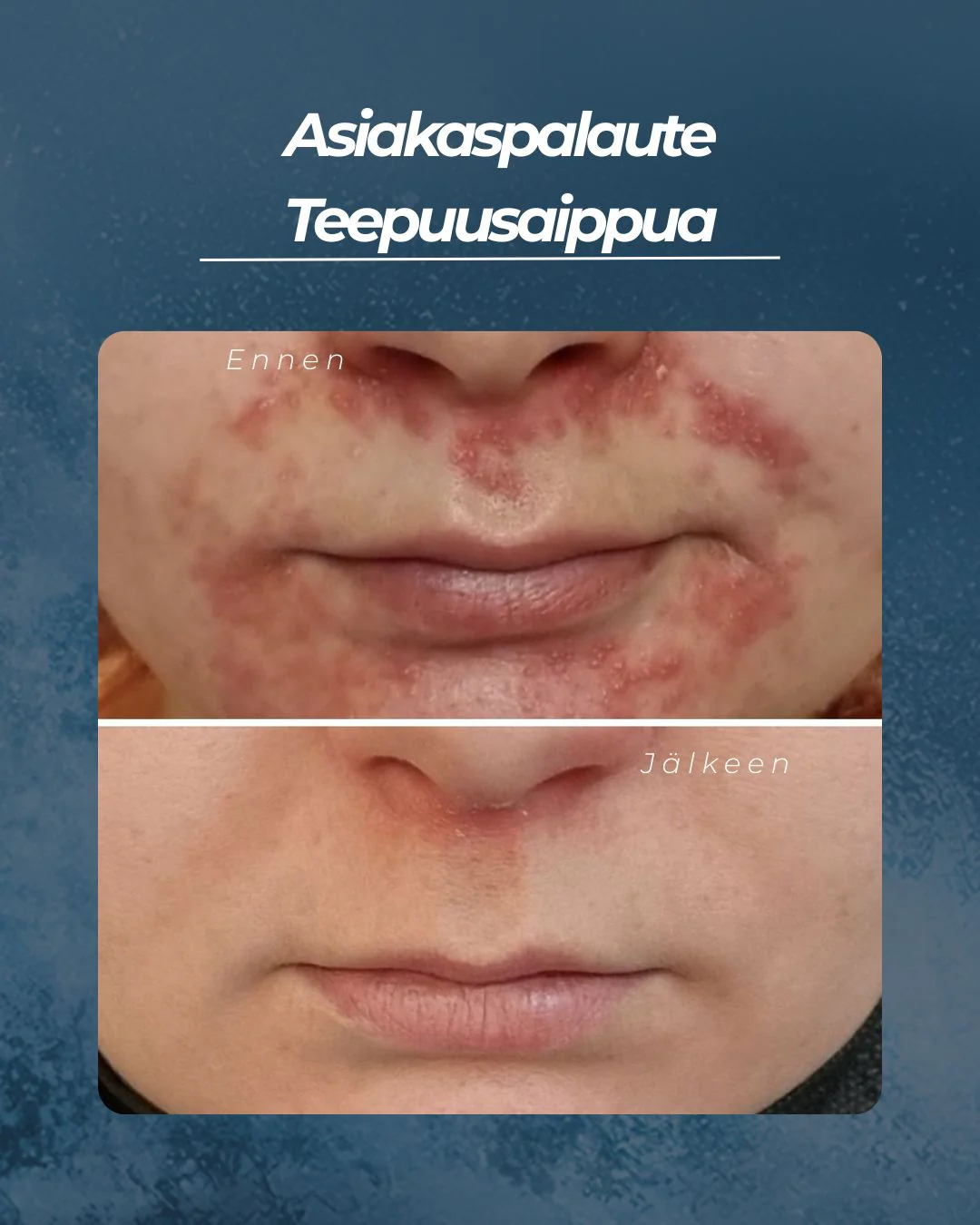 Tuotekuva 7