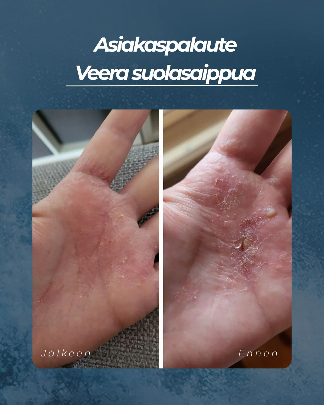 Pikkukuva 2