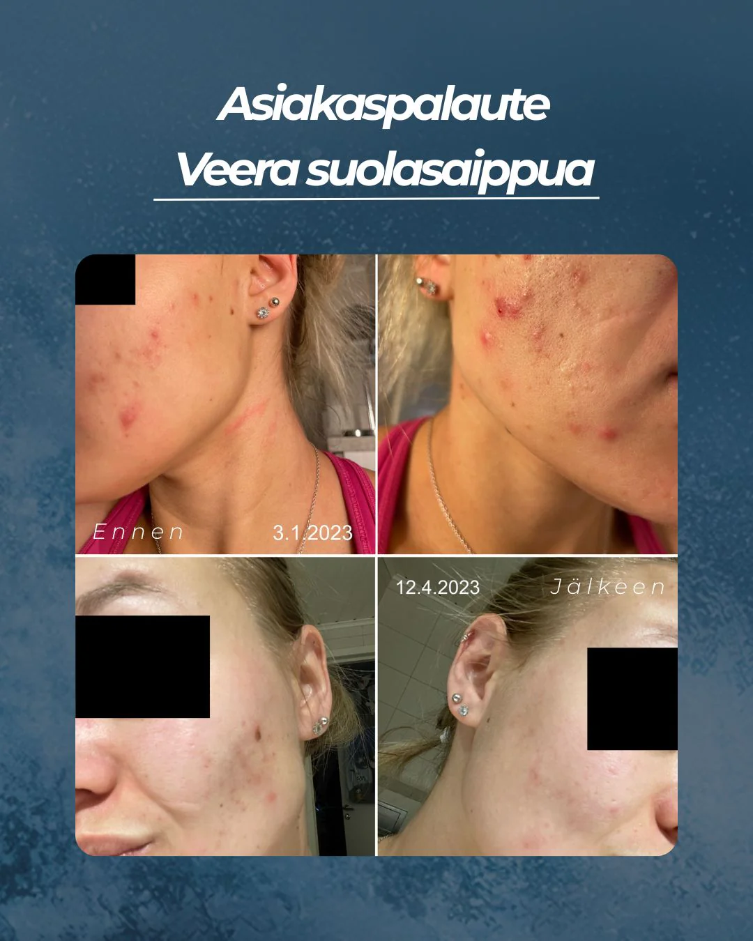Tuotekuva 3